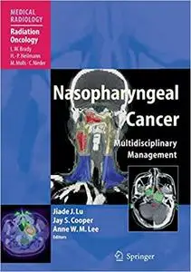 Nasopharyngeal Cancer: Multidisciplinary Management