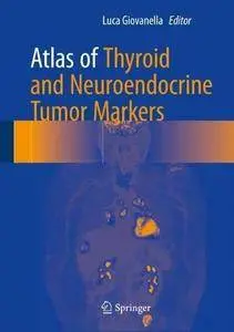 Atlas of Thyroid and Neuroendocrine Tumor Markers [Repost]