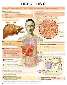 Hepatitis C e chart: Full illustrated