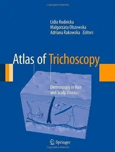 Atlas of Trichoscopy: Dermoscopy in Hair and Scalp Disease (Repost)