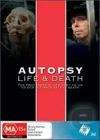 Autopsy Life and Death (4 episodes) (not for weak hearted)