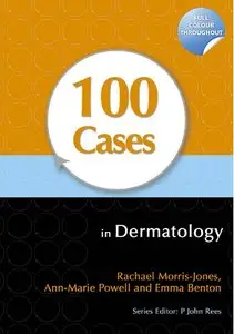 100 Cases in Dermatology