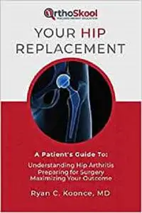 Your Hip Replacement: A Patient's Guide To: Understanding Hip Arthritis, Preparing for Surgery, Maximizing Your Outcome