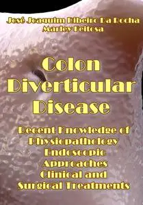 "Colon Diverticular Disease: Recent Knowledge of Physiopathology, Endoscopic Approaches, Clinical and Surgical Treatments"