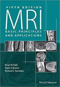 MRI: Basic Principles and Applications