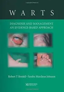 Warts: Diagnosis and Management: An Evidence Based Approach (Repost)