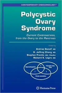 Polycystic Ovary Syndrome: Current Controversies, from the Ovary to the Pancreas (Repost)