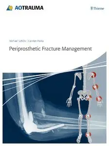 Periprosthetic Fracture Management (Repost)