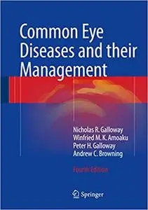 Common Eye Diseases and their Management (Repost)