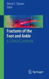 Fractures of the Foot and Ankle: A Clinical Casebook