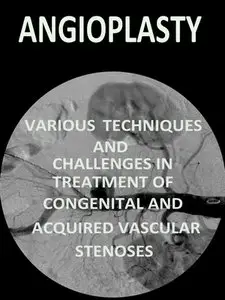 "Angioplasty, Various Techniques and Challenges in Treatment of Congenital and ..." ed. by Thomas Forbes