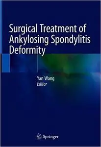 Surgical Treatment of Ankylosing Spondylitis Deformity