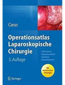 Operationsatlas Laparoskopische Chirurgie: Indikationen - Operationsablauf - Varianten - Komplikationen (Auflage: 3) [Repost]