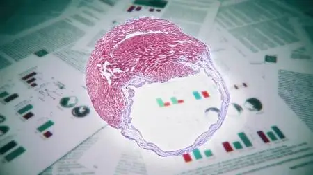 NHK - Breakthrough: Fixing a Broken Heart (2019)