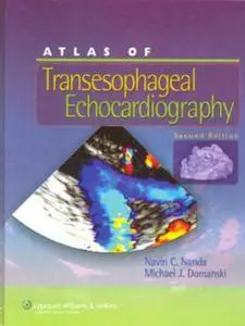 Atlas of Transesophageal Echocardiography, 2 edition