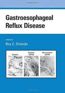 Gastroesophageal Reflux Disease