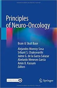 Principles of Neuro-Oncology: Brain & Skull Base