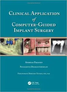 Clinical Application of Computer-Guided Implant Surgery