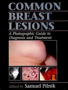 Common Breast Lesions: A Photographic Guide to Diagnosis and Treatment