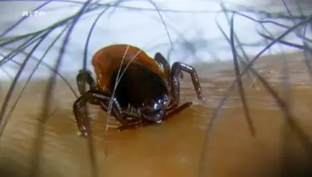 (Arte) La maladie de Lyme, danger réel ou imaginaire (2012)