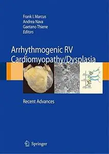 Arrhythmogenic right ventricular cardiomyopathy dysplasia: Recent Advances