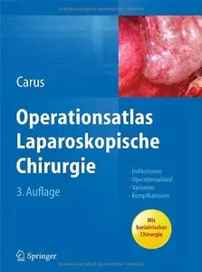 Operationsatlas Laparoskopische Chirurgie: Indikationen - Operationsablauf - Varianten - Komplikationen (Repost)