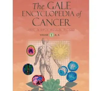 The Gale Encyclopedia of Cancer vol 1 (Repost)