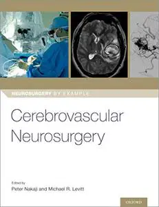 Cerebrovascular Neurosurgery (Repost)