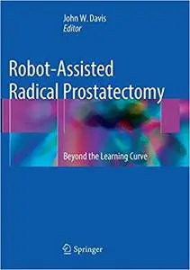 Robot-Assisted Radical Prostatectomy: Beyond the Learning Curve (Repost)