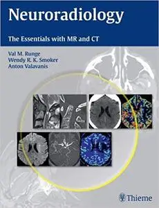 Neuroradiology: The Essentials with MR and CT