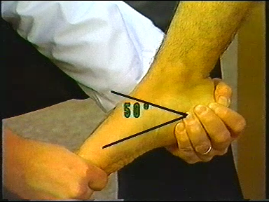 Physical Examination of the Musculoskeletal System (1987)