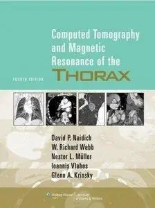 Computed Tomography and Magnetic Resonance of the Thorax (4th edition)