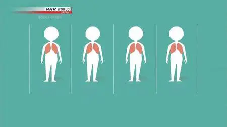 NHK - Medical Frontiers: Cancer Treatment on Target (2018)