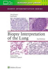 Biopsy Interpretation of the Lung (Repost)