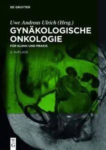 Gynäkologische Onkologie: für Klinik und Praxis (German Edition)