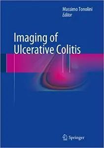 Imaging of Ulcerative Colitis