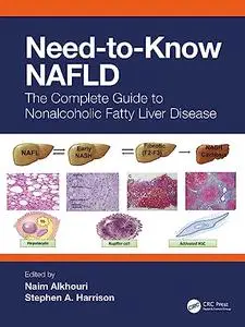 Need-to-Know NAFLD: The Complete Guide to Nonalcoholic Fatty Liver Disease