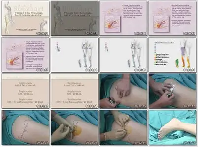 Regional Anaesthesia Procedural skills Videos