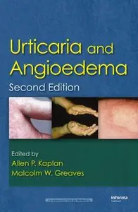 Urticaria and Angioedema, Second Edition