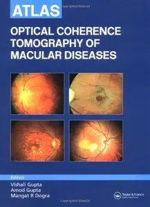 Atlas of Optical Coherence Tomography of Macular Diseases