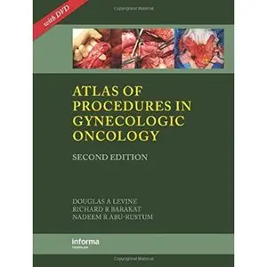 Atlas of Procedures in Gynecologic Oncology, Second Edition by Nadeem R. Abu-Rustum