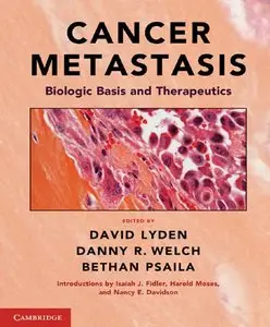 Cancer Metastasis: Biologic Basis and Therapeutics (repost)