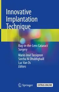 Innovative Implantation Technique: Bag-in-the-Lens Cataract Surgery (Repost)