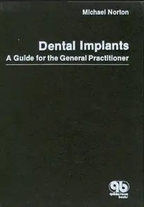 Dental Implants: A Guide for the General Practitioner (Repost)
