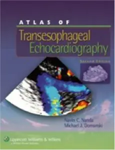 Atlas of Transesophageal Echocardiography, (2nd Edition) (Repost)