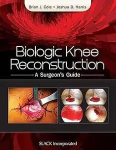 Biologic Knee Reconstruction: A Surgeon's Guide