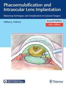 Phacoemulsification and Intraocular Lens Implantation, Second Edition