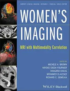 Women's Imaging: MRI with Multimodality Correlation