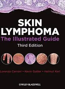 Skin Lymphoma: The Illustrated Guide, Third Edition (Repost)
