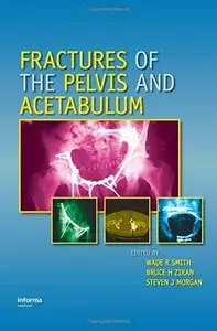 Fractures of the Pelvis and Acetabulum (Repost)